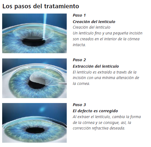 De yodo setochka para el aumento del pecho