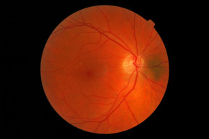 retina del ojo
